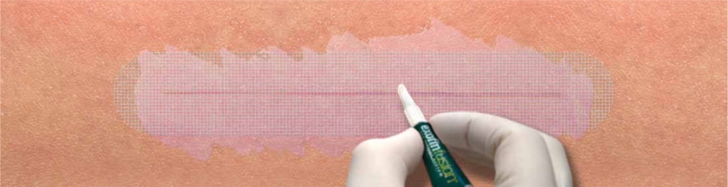 Exofin Verband